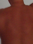 Cunnilingix