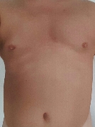 Versautersachse