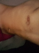 Balose